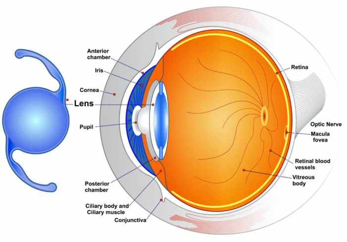 Premium lenses for cataract surgery are not covered by insurance.